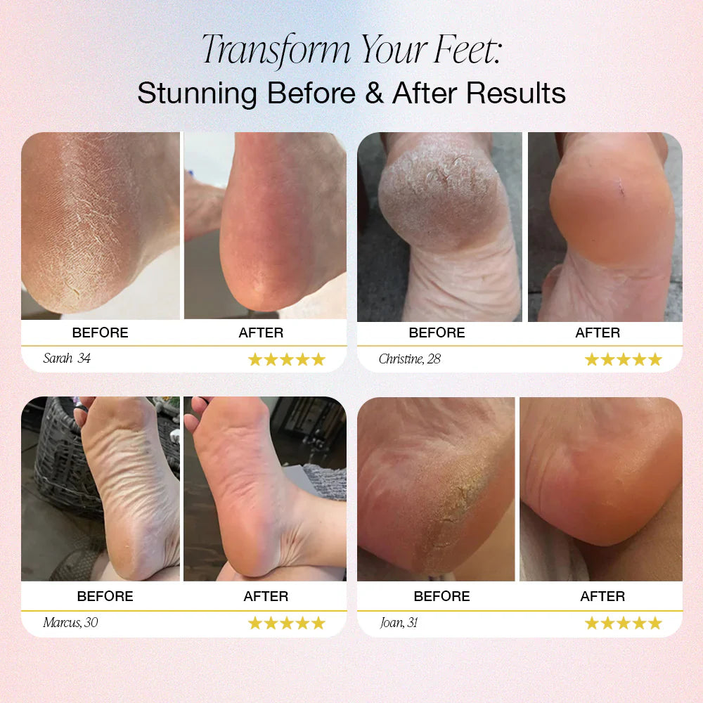 3-piece set LUXGRIP Electric Foot Callus Remover